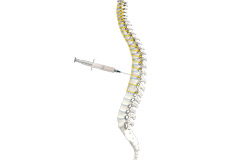 Sympathetic Nerve Block
